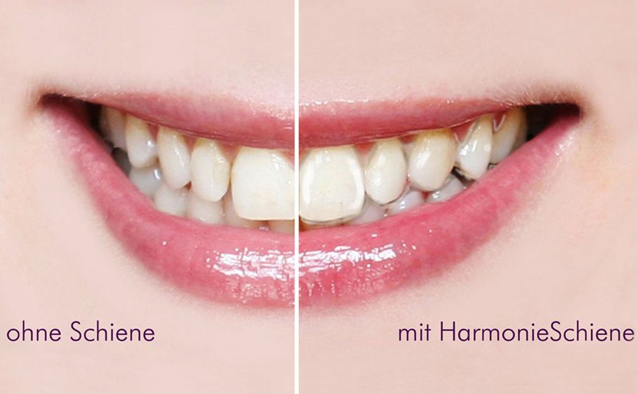 HarmonieSchiene®